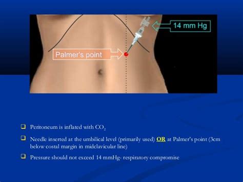 Basics in gyne laparoscopy