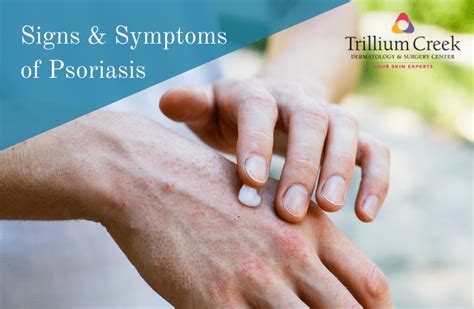 Signs & Symptoms of Psoriasis - Trillium Creek Dermatology