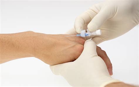 IV cannulation procedure for nurses - How to place a peripheral IV catheter (PIVC) | Stick to ...