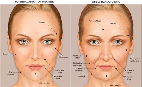 Best Product For Sagging Jowls - Get More Anythink's