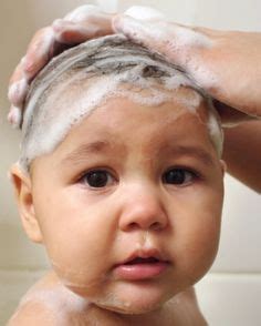 9 Eczema baby :( ideas | eczema, eczema remedies, eczema cream