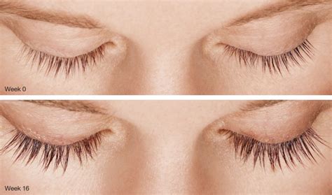 Latisse for Longer, Thicker Eyelashes | Vujevich Dermatology