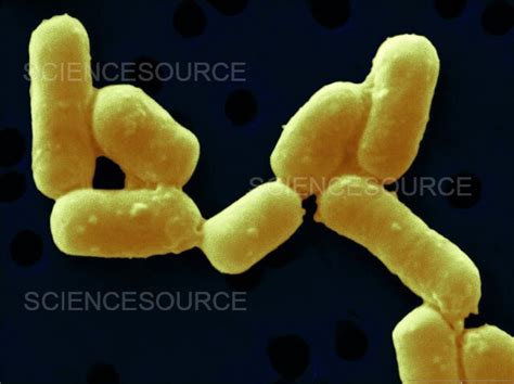 Lactobacillus fermentum | Stock Image - Science Source Images