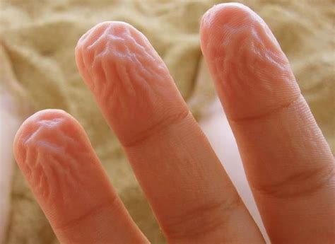 Fingertips Get Sore at Lee Patterson blog