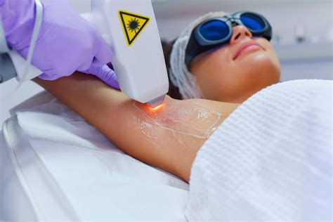 Hair Removal Laser: The history of laser hair removal