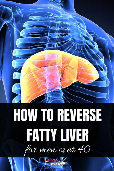 How to Reverse Fatty Liver - Lean Over 40 For Men | Fatty liver, Fatty liver diet, Fatty liver ...