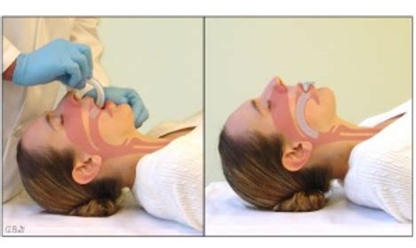 Oropharyngeal Airway Measurement