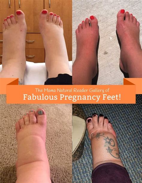 How To Help Swelling In Pregnancy - Rowwhole3