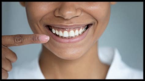 The Fascinating link between Vitamin K2 and Oral Health - Dentist Ahmed