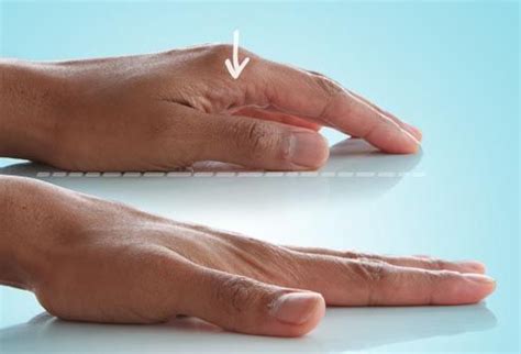 10 Ways to Exercise Hands & Fingers Arthritis Exercises, Rheumatoid Arthritis Symptoms ...