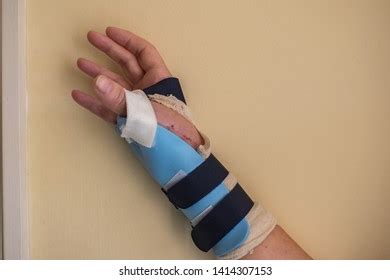 13 Basal Thumb Pain Royalty-Free Images, Stock Photos & Pictures | Shutterstock