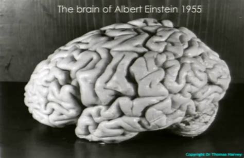 Diseccionando el cerebro de Einstein