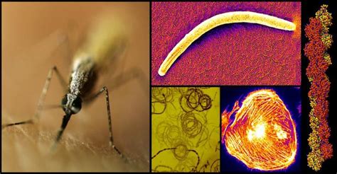 Why Malaria Parasites are Faster Than Human Immune Cells | Infection Control Today