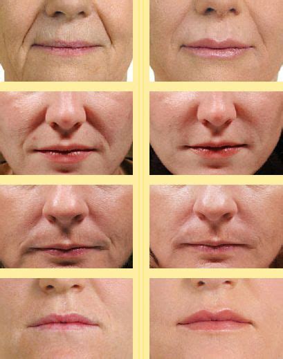 DIY Non-Invasive Facelift With Face Toning Exercises: Face Fitness Workout Techniques Old School ...