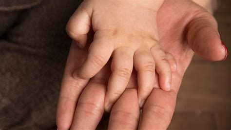 Understanding Congenital Anomalies: Symptoms, Causes, And Prevention Tips For Birth Defects ...