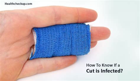 How Do You Know If A Wound Is Infected With Tetanus : Complications of tetanus infection may ...