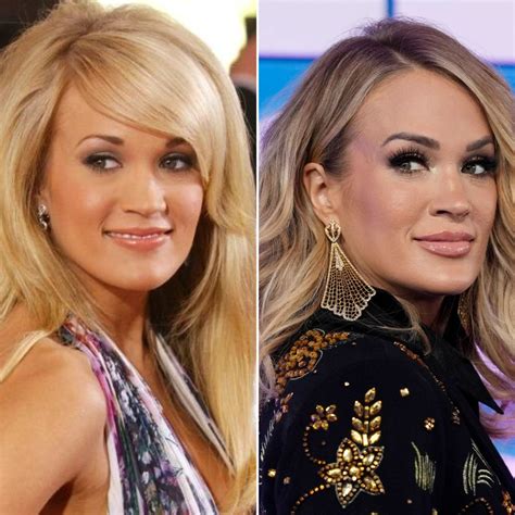 Everything Carrie Underwood Has Said About Plastic Surgery: Photos of ...