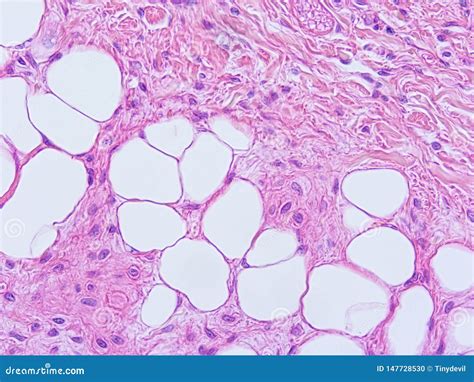 Histology of Epiglottis Human Tissue Stock Photo - Image of research, science: 147728530