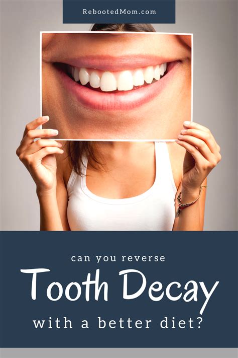 Can you Reverse Tooth Decay with a Better Diet?