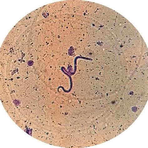 Microfilaria from blood by Giemsa's stain | Download Scientific Diagram