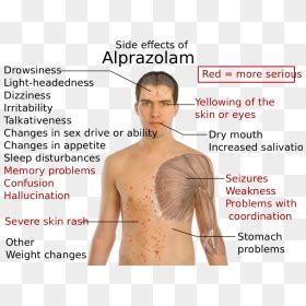 Side Effects Of Alprazolam - Que Hace El Alprazolam, HD Png Download - vhv