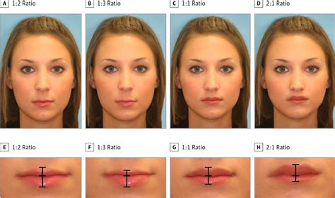 The Most Beautiful Female Lips; Study Finds 1:2 Ratio Is Most Attractive For A Woman’s Face