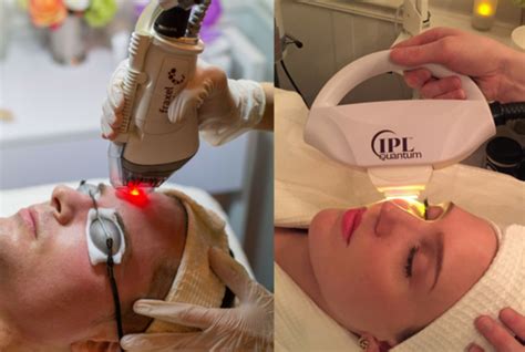 Clear + Brilliant vs. IPL Photofacial | Ipl photofacial, Photofacial, Ipl