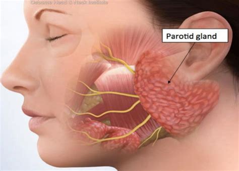 Swollen Salivary Glands Bulimia