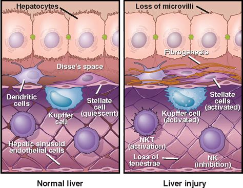 Evaluating Liver Test Abnormalities: The Normal Liver