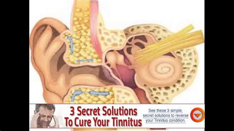 what causes tinnitus with tmj - YouTube
