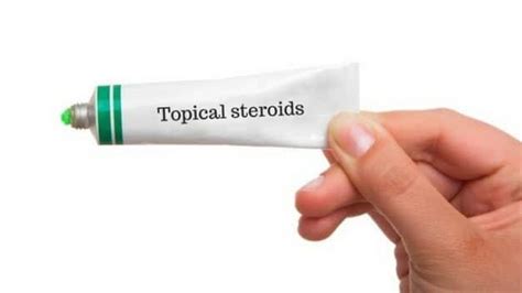 cropped-Topical-steroids-feature.jpg – TANGS CLINICAL TCM