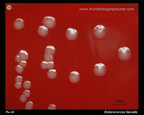 Colonies of Enterococcus faecalis on agar plate. Enterococcus faecalis colonies on blood agar in ...