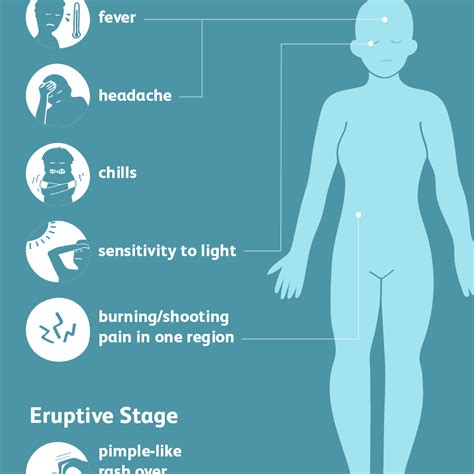 How Shingles Is Treated