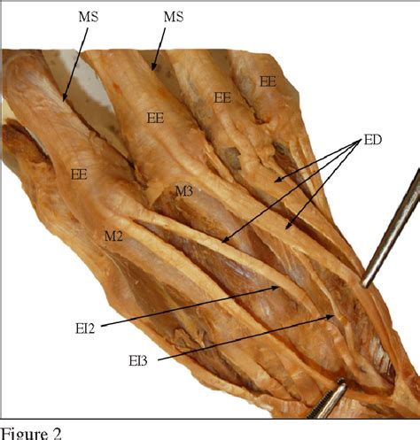 Extensor Indicis Cadaver