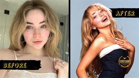 Sabrina Carpenter plastic surgery rumors remain purely speculative