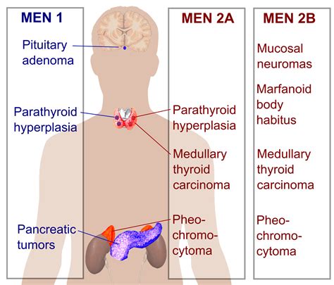 Multiple endocrine neoplasia, Endocrine, Endocrine system