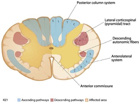 Spinal cord disorders - Dizziness-Doctor.com