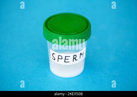 Health. Close up Sperm Analysis. Concept of Bank Sperm. Infertility