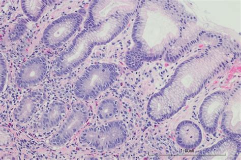 Melimtx of leaks porn noticed Alexa’s advertisement and