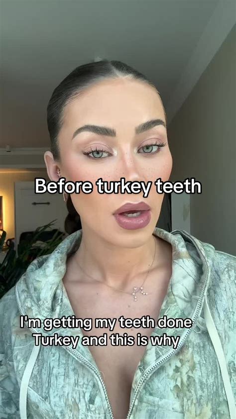 Transforming Natural Teeth with Cosmetic Crowns | TikTok