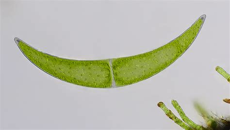 Amateur Microscopy | Dead cell of Closterium | Facebook