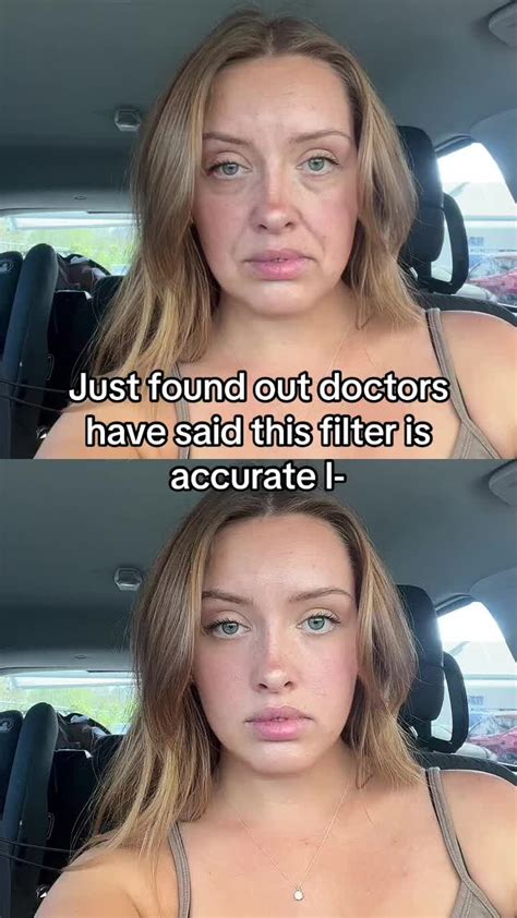 Chloe Mira Dillon Filter: The Accurate Doctors' Verdict | TikTok