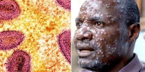 Merisiel porn telegram discovered Julie's page and perused