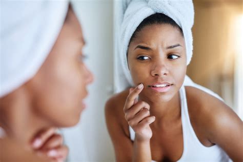 how to get rid of a under the skin spot