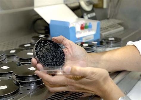 «legionela», mejor que «legionella» | Fundéu
