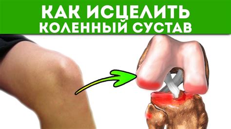 Смотри сегодня, чтобы исцелить коленные суставы завтра! Боль в коленях ...
