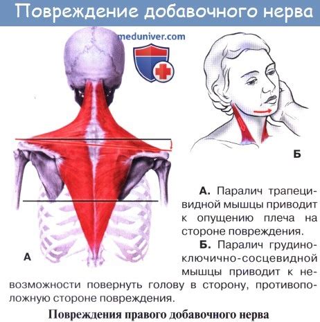 Анатомия: Добавочный нерв (XI пара, 11 пара черепных нервов), n ...