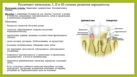 Пародонтит и пародонтоз » Привет Студент!