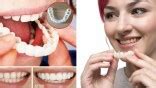 ХИТ! Зубная накладка "Snap-On Smile": купить в Москве и Санкт ...