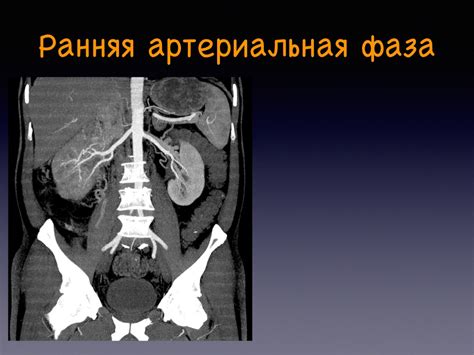 Протоколы КТ Брюшной полости: подготовка, болюсное контрастирование, фазы